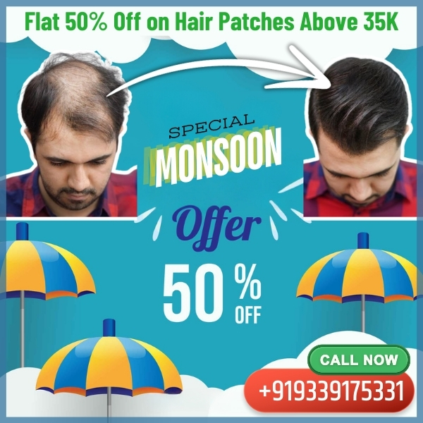 Up to 50% off on all hair wigs and hair patches at non-surgical hair replacement center Salt Lake, kolkata this Monsoon Season. Best offer on hair wigs and hair patches in Kolkata.