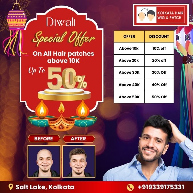 Best non-surgical hair replcaement center in Salt Lake, kolkata. Diwali offer for Hair wigs for men in Salt Lake, Kolkata. Diwali offer for Hair patches for men in Salt lake, Kolkata. Hair wigs and hair wigs for men in kolkata starting just ₹5999. Flat 50% off on hair wigs & hair patches above 50K in salt lake, kolkata.