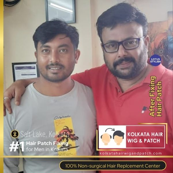 Best hair wigs and hair patches for men in kolkata at lotus stylish in salt lake. Number 1 non-surgical hair replacement service in kolkata is Lotus Stylish. At Lotus stylish in Salt lake, kolkata, you get best hair wigs and hair patches for men in kolkata. Book free demo and consultation for hair replacement with hair wigs and hair patches for men in Kolkata.