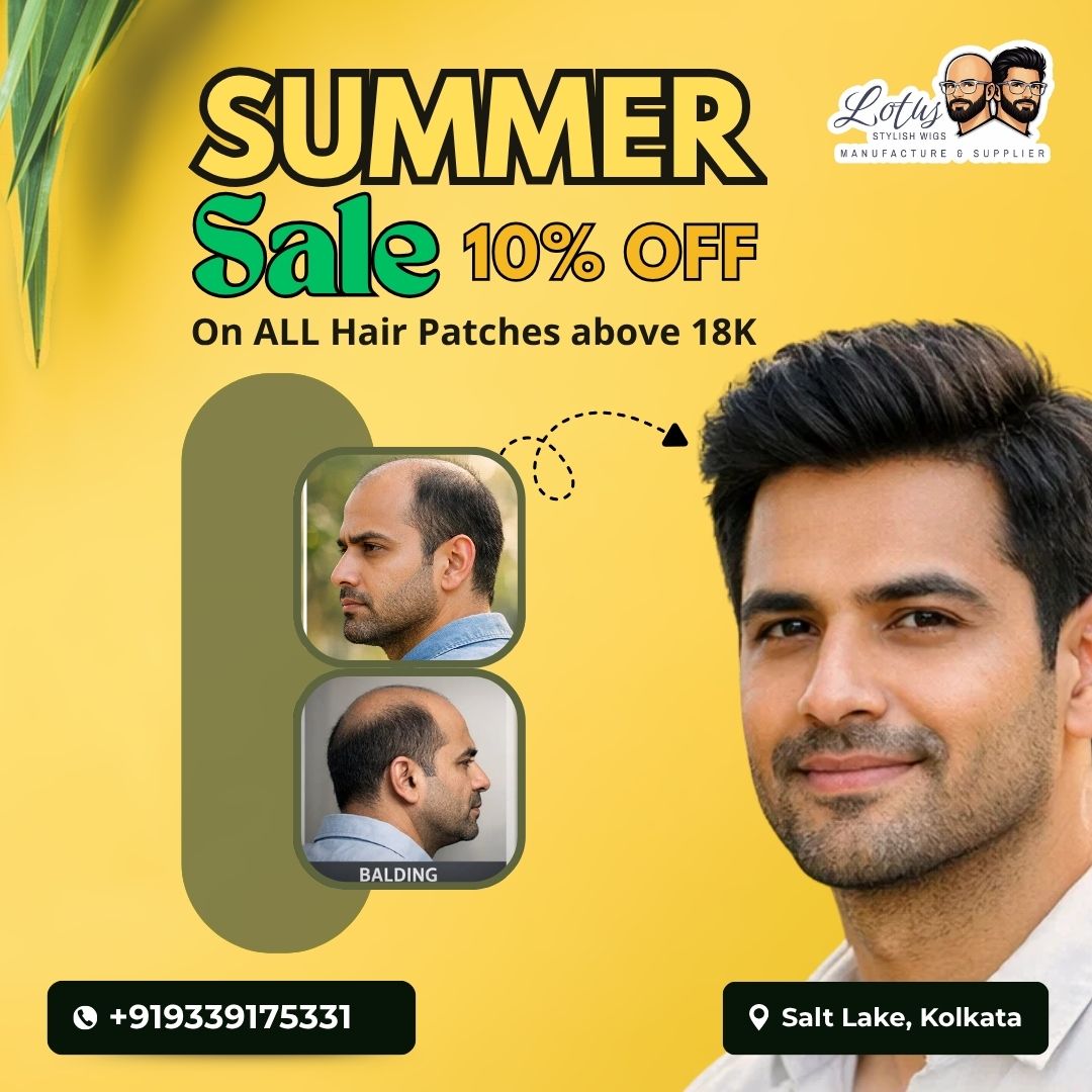 Summer Special: 10% off on hair wigs and hair patch for men in Salt Lake and ballygunge south Kolkata
