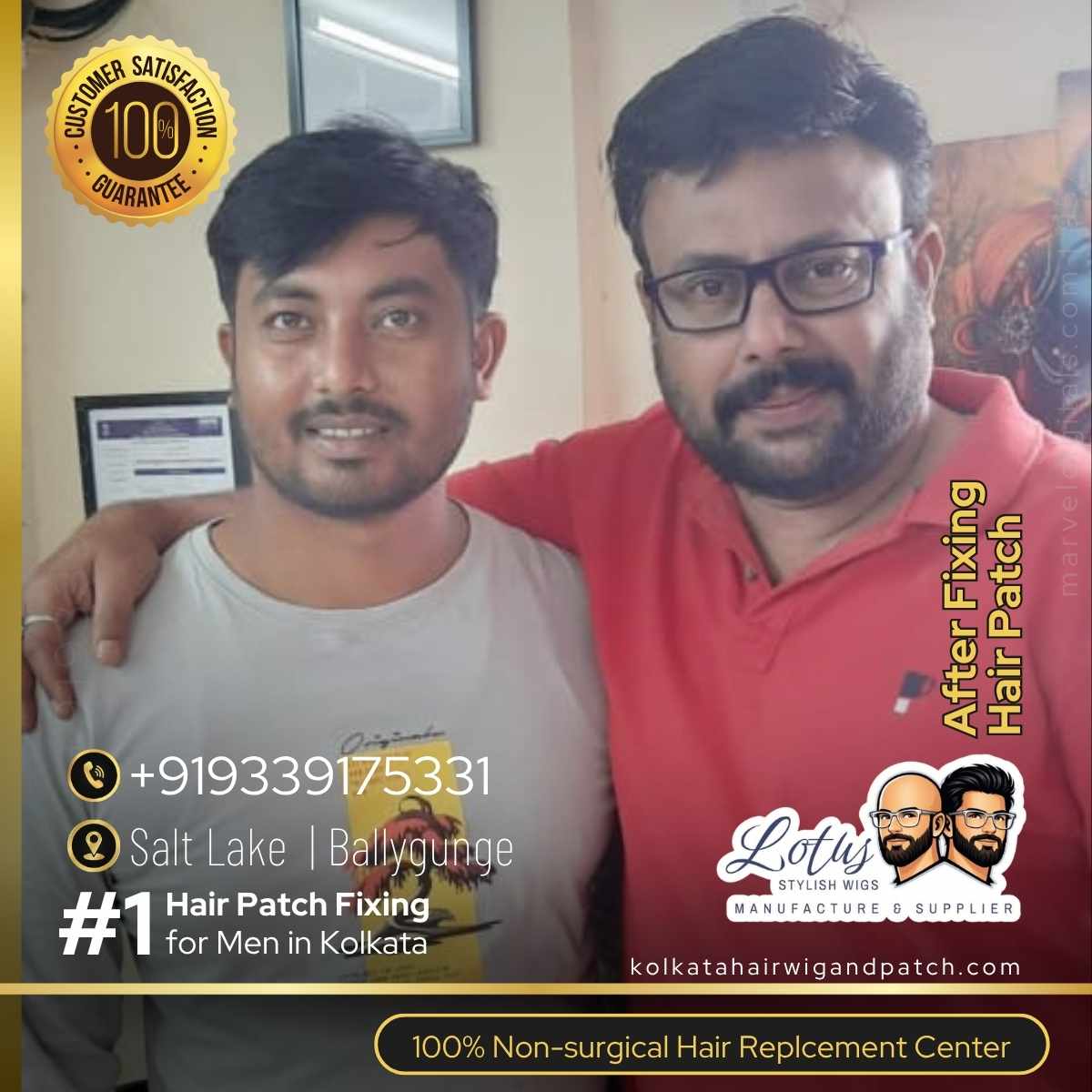 Lotus-Stylish-Wigs-Manufacture-and-Supplyer-Saltlake-sector-1-ballygunge-kolkata-Non-surgical-hair-replacement-center-best-hair-wig-shop-in-kolkata-04-trusted-by-bengal-actor