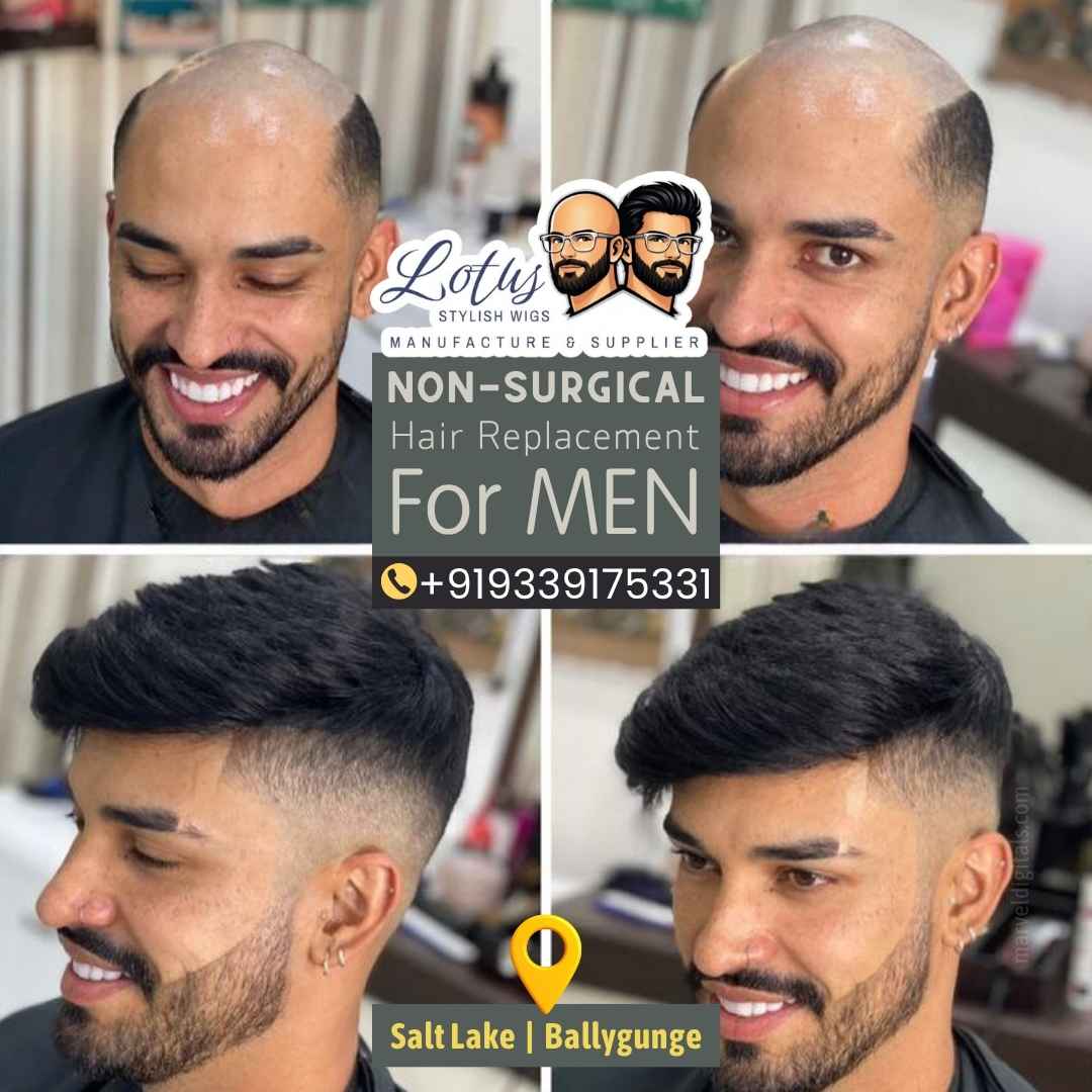 Lotus-Stylish-Wigs-Manufacture-and-Supplyer-Saltlake-sector-1-kolkata-Non-surgical-hair-replacement-center-best-hair-wig-shop-in-kolkata-02