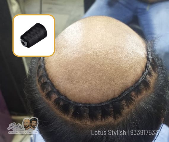 Hair patch weaving for men in kolkata at salt lake and ballygunge - best hair wig shop in kolkata